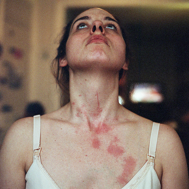 2-Scratches from breastfeeding